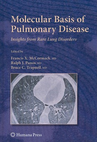 Carte Molecular Basis of Pulmonary Disease Francis X McCormack