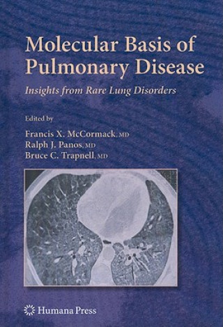 Kniha Molecular Basis of Pulmonary Disease Francis X McCormack