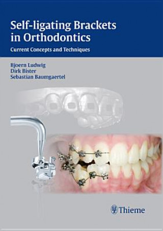 Knjiga Self-ligating Brackets in Orthodontics B Ludwig