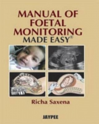 Kniha Manual of Fetal Monitoring Made Easy Richa Saxena