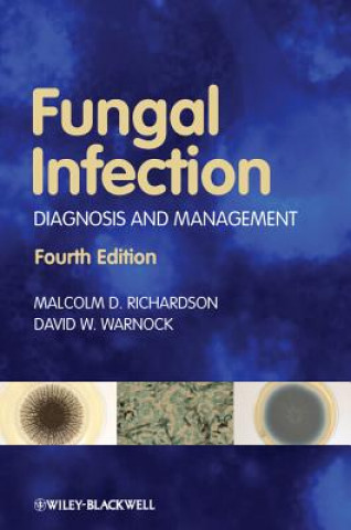 Kniha Fungal Infection - Diagnosis and Management 4e Malcolm D Richardson