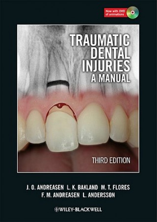 Kniha Traumatic Dental Injuries - A Manual 3e Jens O Andreasen