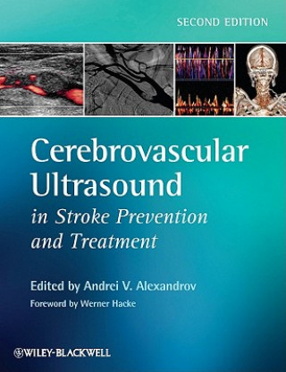 Carte Cerebrovascular Ultrasound in Stroke Prevention and Treatment 2e Andrei V Alexandrov