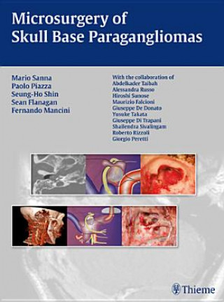 Książka Microsurgery of Skull Base Paragangliomas Mario Sanna