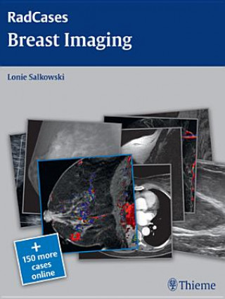 Książka Radcases Breast Imaging Lonie Salkowski
