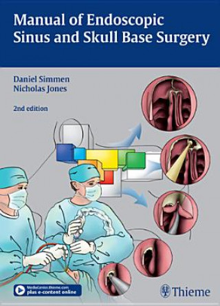 Knjiga Manual of Endoscopic Sinus and Skull Base Surgery Daniel Simmen