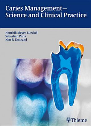 Kniha Caries Management - Science and Clinical Practice Hendrik Meyer-Lückel