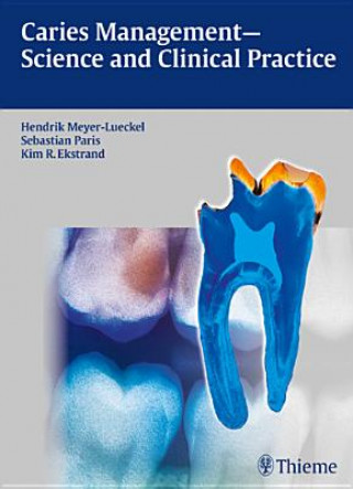 Book Caries Management - Science and Clinical Practice Hendrik Meyer-Lückel