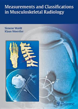 Könyv Measurements and Classifications in Musculoskeletal Radiology Simone Waldt