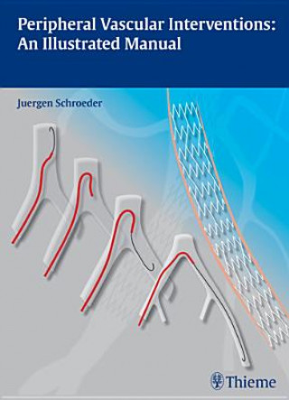 Könyv Peripheral Vascular Interventions: An Illustrated Manual Juergen Schroeder