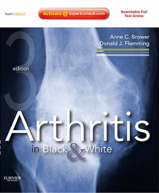 Kniha Arthritis in Black and White Anne C Brower