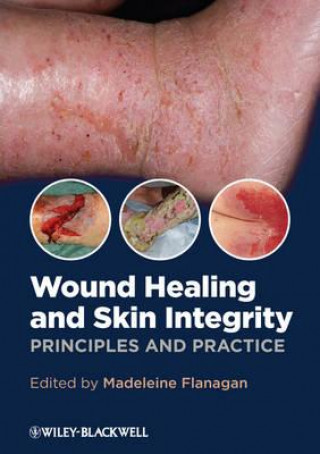 Livre Wound Healing and Skin Integrity - Principles and Practice Madeleine Flanagan