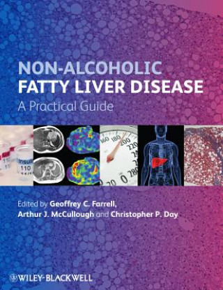 Carte Non-Alcoholic Fatty Liver Disease - A Practical Guide Geoffrey C Farrell