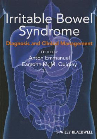 Book Irritable Bowel Syndrome - Diagnosis and Clinical Management Anton Emmanuel