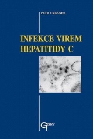 Книга Infekce virem hepatitidy C Petr Urbánek