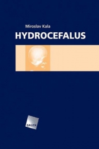 Livre HYDROCEFALUS Miroslav Kala