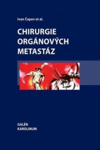 Kniha Chirurgie orgánových metastáz Ivan Čapov et al.