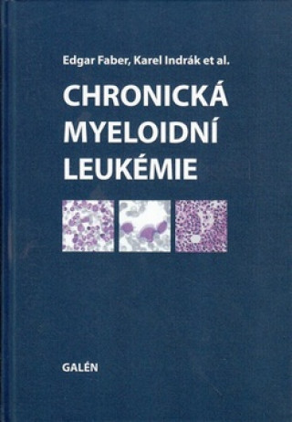 Book Chronická myeloidní leukémie Edgar Faber