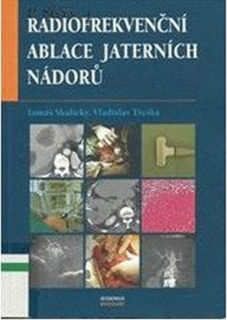 Kniha Radiofrekvenční ablace jaterních nádorů Tomáš Skalický