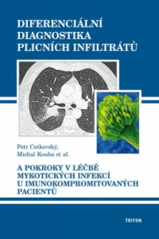 Kniha Diferenciální diagnostika plicních infiltrátů Petr Cetkovský