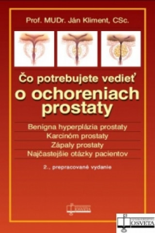 Kniha Čo potrebujete vedieť o ochreniach prostaty Ján Kliment