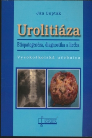 Knjiga Urolitiáza. Etiopatogenéza, diagnostika a liečba Ján Ľupták