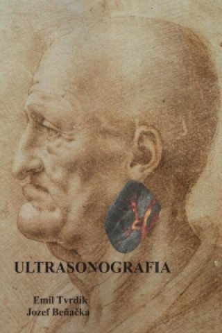 Kniha Ultrasonografia Emil Tvrdík
