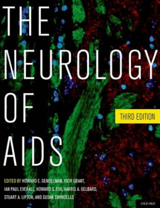 Carte Neurology of AIDS Howard E Gendelman