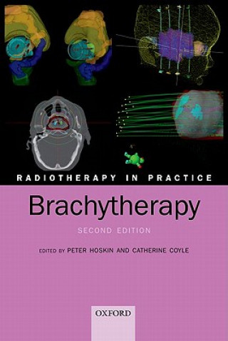 Knjiga Radiotherapy in Practice - Brachytherapy Peter J Hoskin