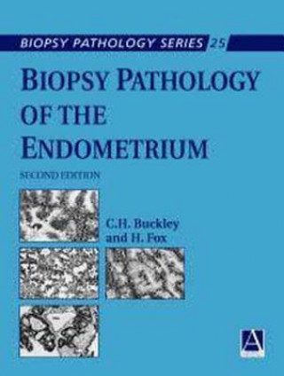 Libro Biopsy Pathology of the Endometrium, 2Ed H Fox