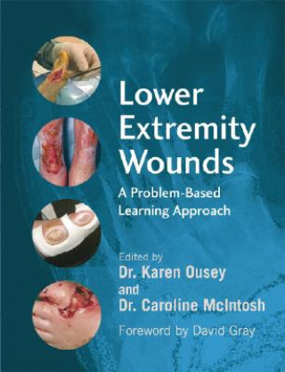 Carte Lower Extremity Wounds - A Problem-Based Learning Approach Karen Ousey