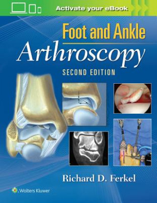 Könyv Foot & Ankle Arthroscopy Richard D Ferkel