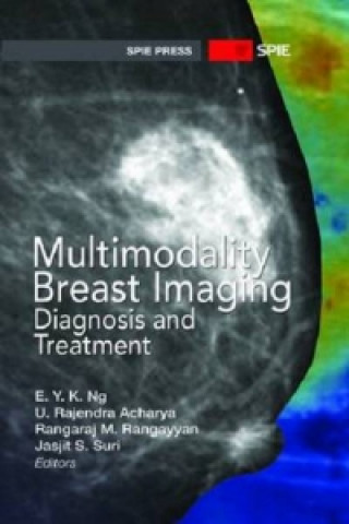 Könyv Multimodality Breast Imaging E Y K Ng & Rajendra Acharya