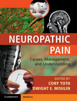 Book Neuropathic Pain Cory Toth