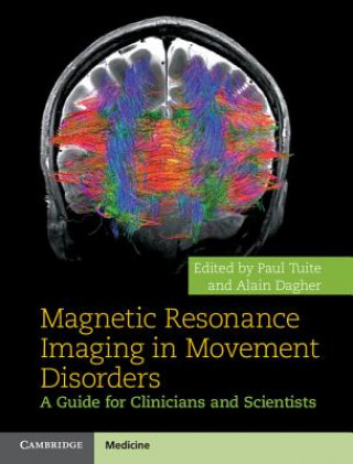 Книга Magnetic Resonance Imaging in Movement Disorders Paul Tuite