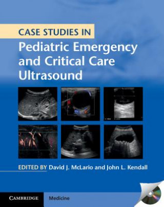 Kniha Case Studies in Pediatric Emergency and Critical Care Ultrasound with DVD-ROM David J McLario