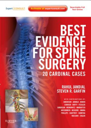 Kniha Best Evidence for Spine Surgery Rahul Jandial