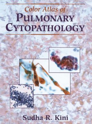 Kniha Color Atlas of Pulmonary Cytopathology Sudha R Kini