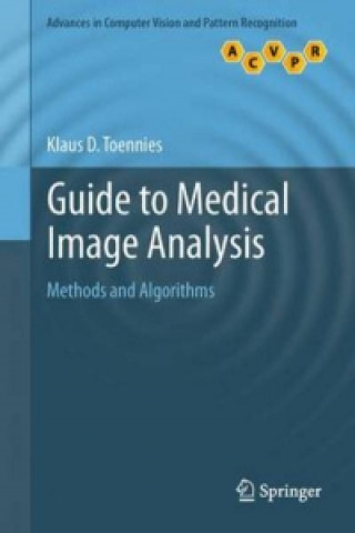 Książka Guide to Medical Image Analysis Klaus D Toennies