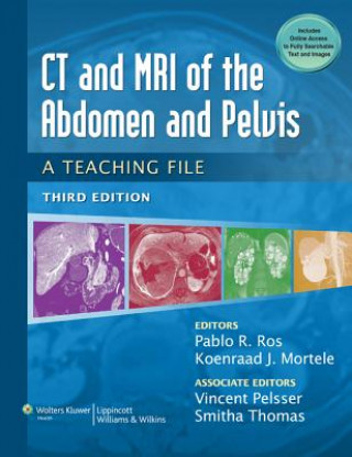Kniha CT & MRI of the Abdomen and Pelvis Pablo R Ros