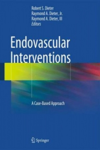 Carte Endovascular Interventions Robert S. Dieter