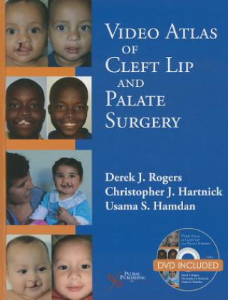 Książka Video Atlas of Cleft Lip and  Palate Surgery Derek Rogers