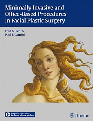 Carte Minimally Invasive and Office-Based Procedures in Facial Plastic Surgery Fred G. Fedok