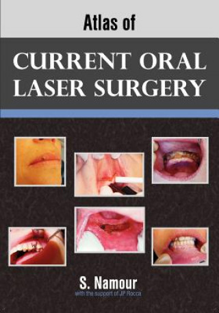 Książka Atlas of Current Oral Laser Surgery S Namour