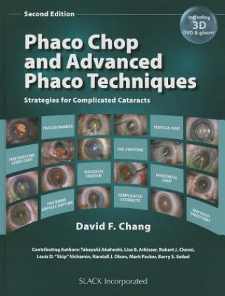 Kniha Phaco Chop and Advanced Phaco Techniques David Chang