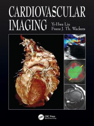 Książka Cardiovascular Imaging Yi-Hwa Liu