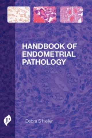 Knjiga Handbook of Endometrial Pathology Debra S Heller