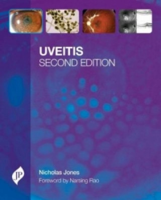 Kniha Uveitis Nicholas P Jones