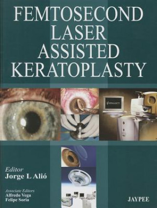 Carte Femtosecond Laser Assisted Keratoplasty Jorge L Alio