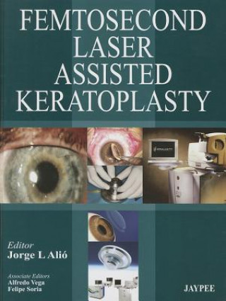 Kniha Femtosecond Laser Assisted Keratoplasty Jorge L Alio